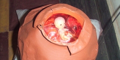 Foetus02