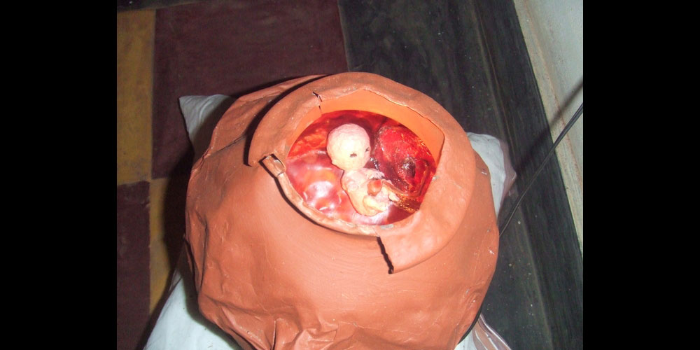 Foetus02